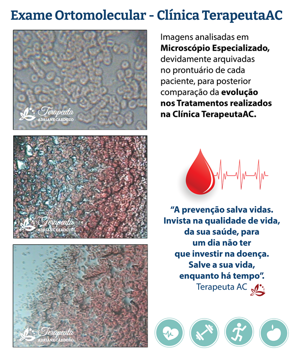 Exame Ortomolecular gota sangue microscópio TerapeutaAC Homeopata Salto
